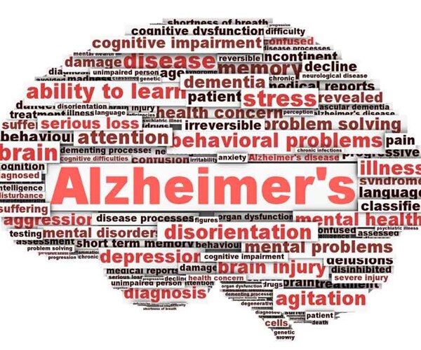 Lilly Failure a Blow for Alzheimer's Research, Not End of Road