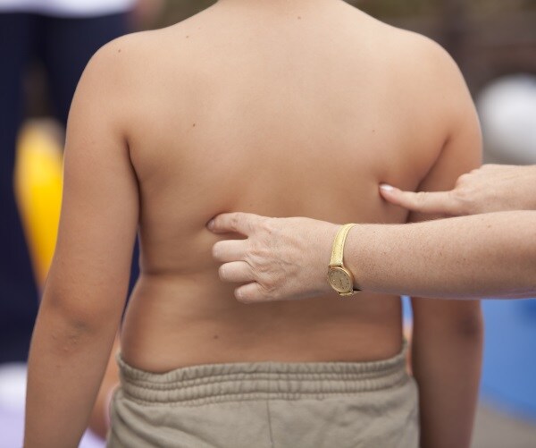 Third of US Kids Eat Fast Food Daily