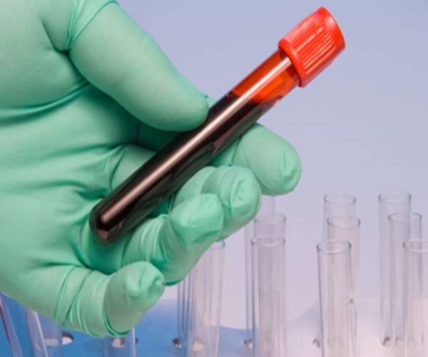 Blood Test Could 'Personalize' Cancer Immunotherapy