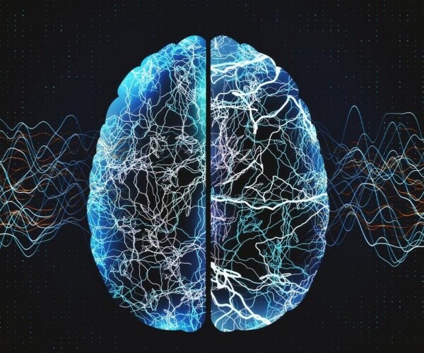 computer generated image of brain