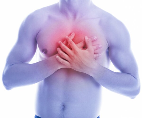 Kidney Stones Linked to Heart Disease