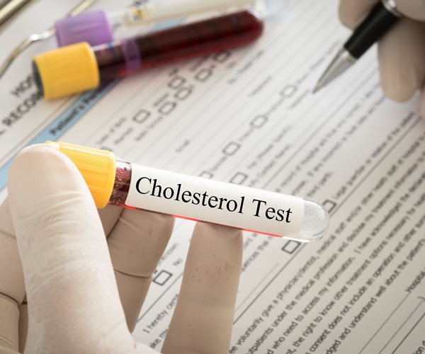 Facts You Need to Know About High Cholesterol