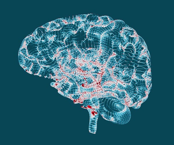 Ultrasound Might Ease Parkinson's Tremors