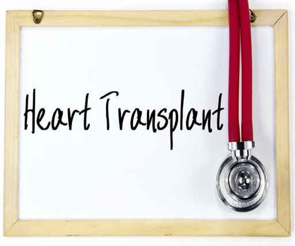 Past and Future of Organ Transplants