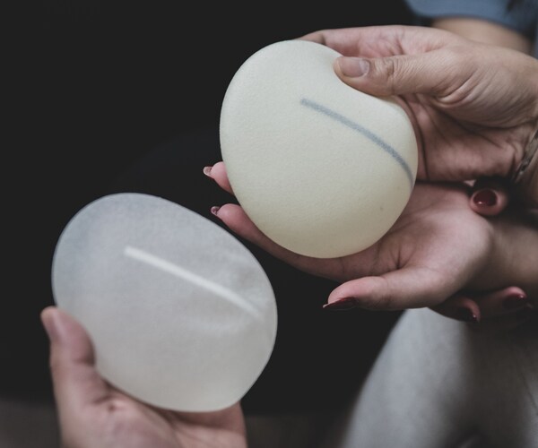 Breast implants