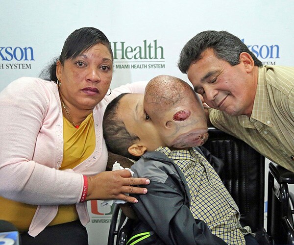 Emanuel Zayas Dies Days After Large Tumor Removed From Face