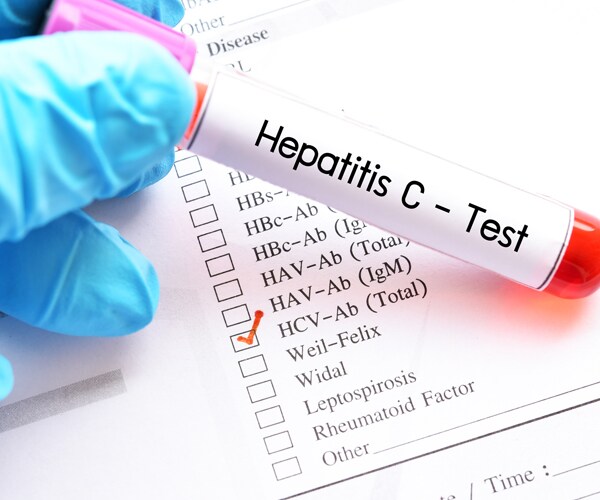 hepatitis c test