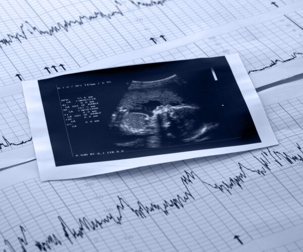 heartbeats and hope for newborns 