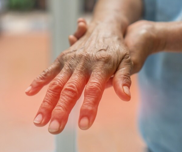 person has pain in hand due to peripheral neuropathy