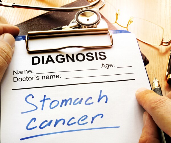 stomach cancer