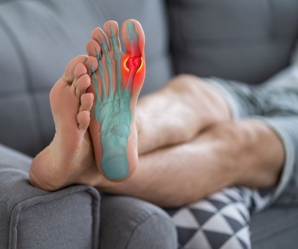 person's foot up on couch with illustration showing gout in the big toe