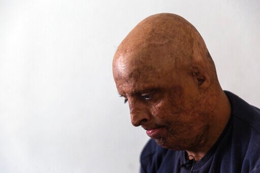 Self-immolation Persists as Grim Form of Protest in Tunisia