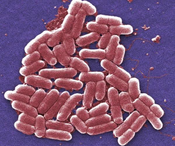 sepsis occurs when the body goes into overdrive while fighting an infection