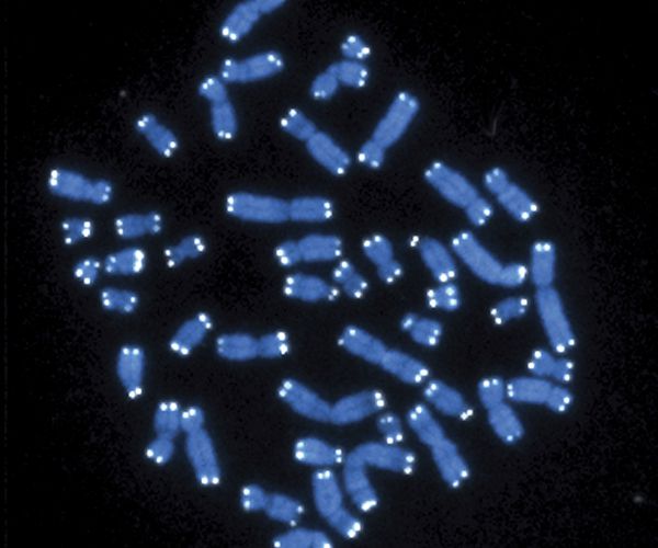 Depression, Alzheimer's May Be Part of Same Process