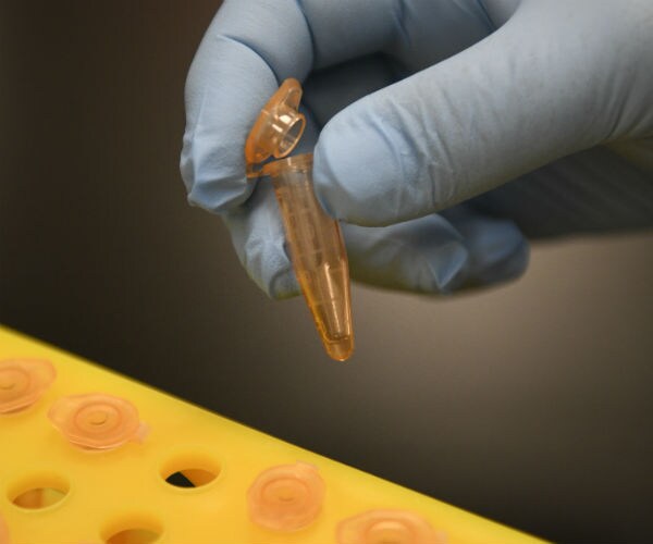 New Blood Test Can Spot Cancer in 10 Minutes