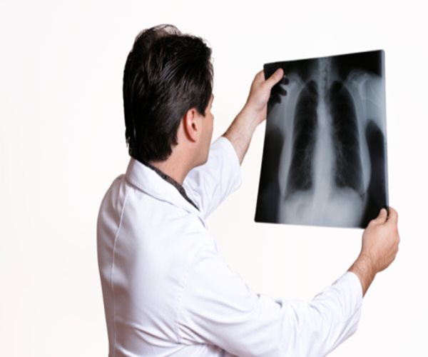 Two Lung Diseases Killed 3.6 Million in 2015: Study