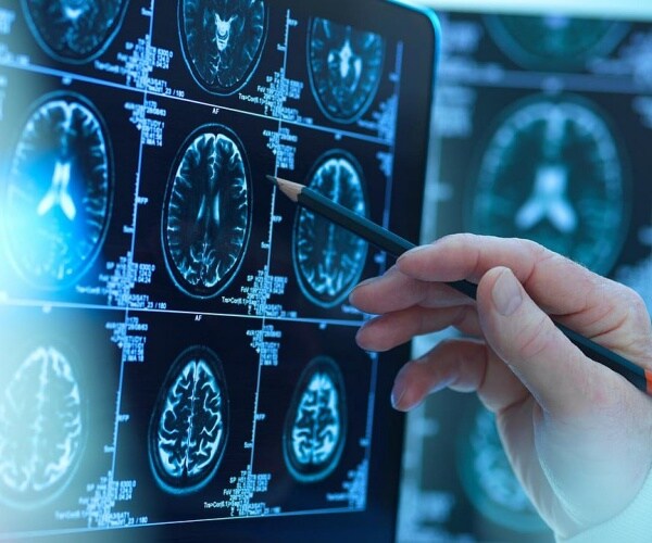 physician reviewing brain scans