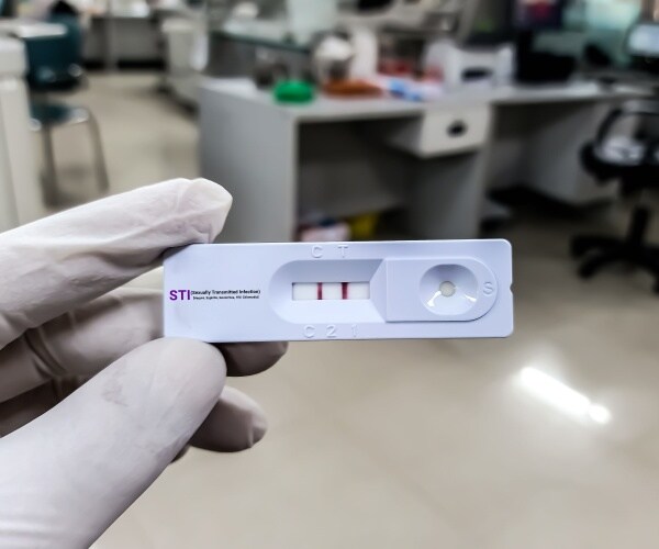 an at-home test for STI