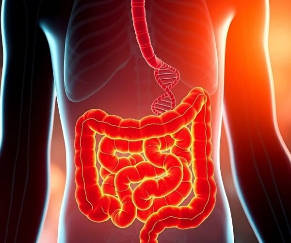 Lowered Screening Age Leads to More Colon Cancers Detected Earlier