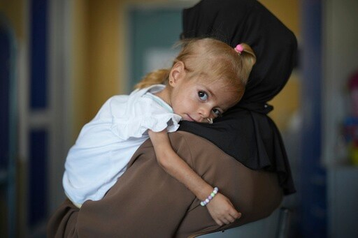 Toddler Evacuated from Gaza with Rare Disease Recovers from Malnutrition in Italian Hospital