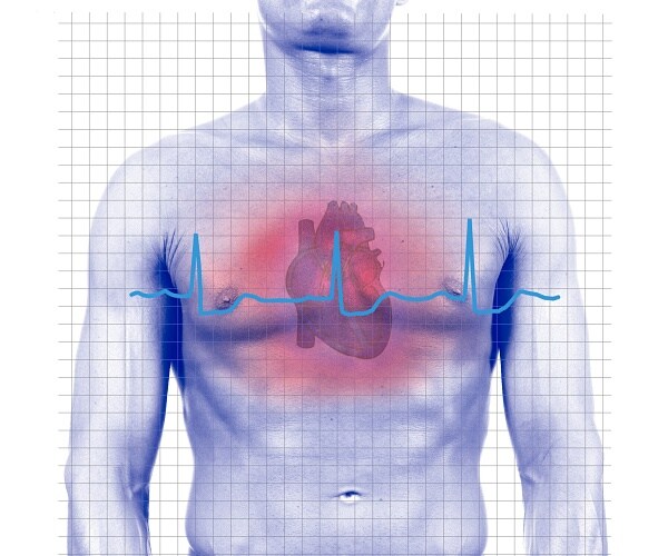 Experimental Drug Offers Hope for Rare Heart Condition