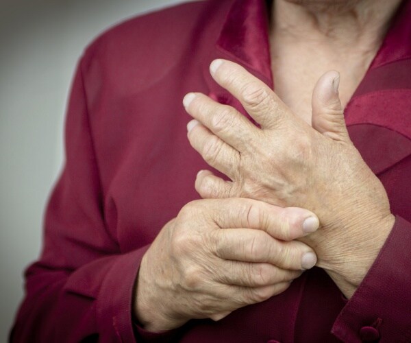 hands of a woman with arthritis wearing a burgundy top