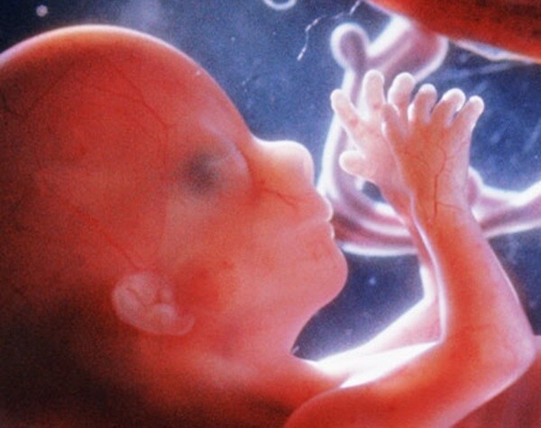 Bill Legalizing Abortion Passed in Pope's Native Argentina