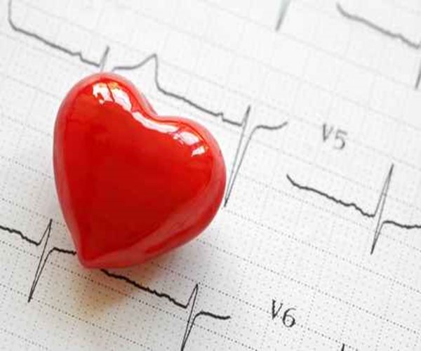 Irregular Heartbeat Tied to Several Health Risks 