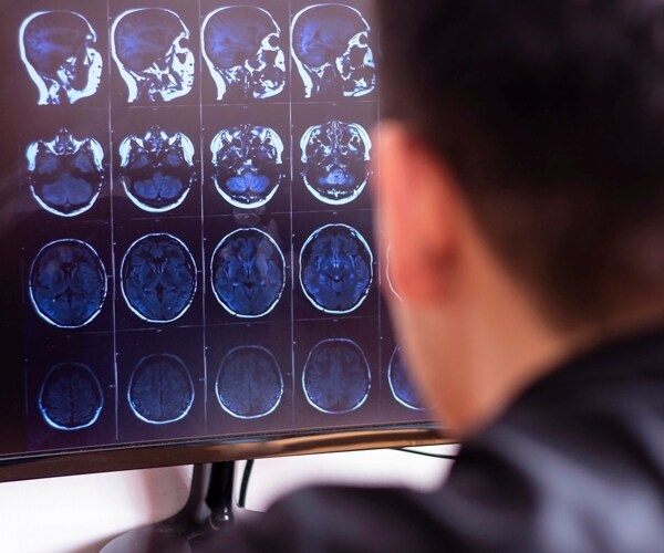 a doctor looks at brain scans