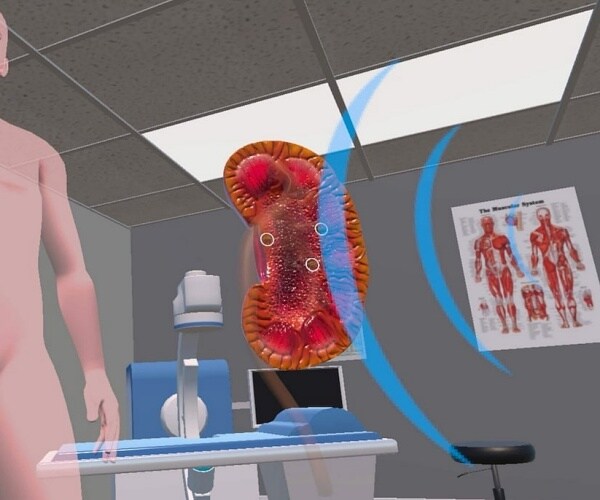 snapshot of virtual reality video on medical procedure