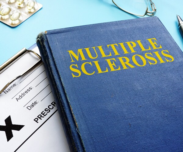 Multiple sclerosis