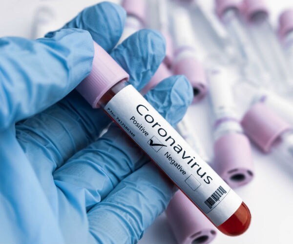 covid nineteen or coronavirus testing 