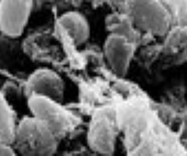 US Reports Unusual Spike in Human Plague Cases