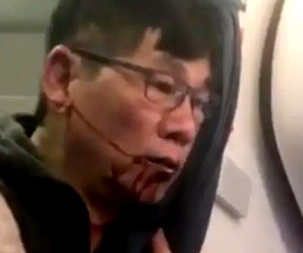 Physician Who Was Dragged Off Flight Settles with United