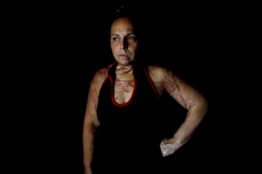AP PHOTOS: Portraits of Argentine Victims of Gender Violence