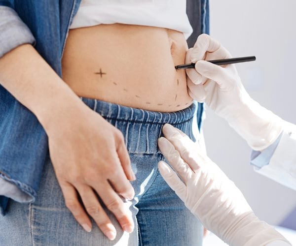 The No. 1 Plastic Surgery Procedure Performed Is…