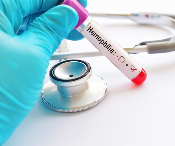 a vial of blood labeled hemophilia