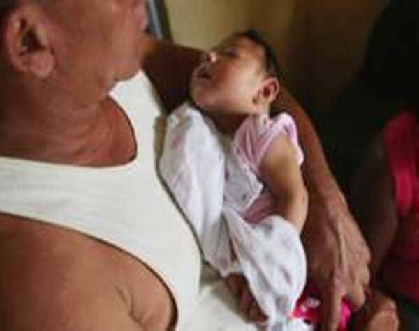 More US Babies with Zika-related Birth Defects Reported by Health Agency