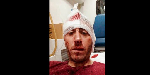 Bosnia Journalists Rally again after TV Reporter Beaten