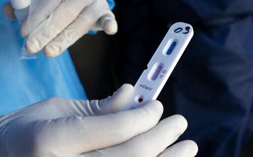 Venezuela's Go-to Test for Fighting Virus Raising Questions