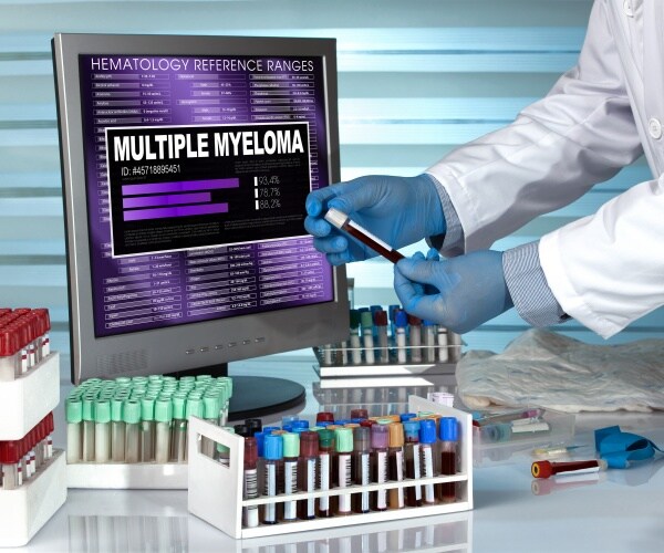 scientist in lab looking at blood samples for multiple myeloma