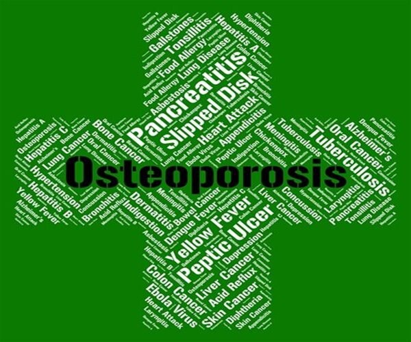 Stem Cell Therapy Reverses Age-Related Osteoporosis