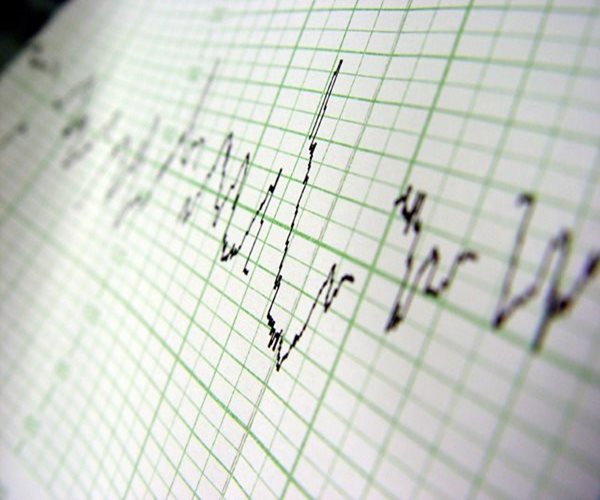 Undiagnosed 'A-Fib' May Be Common