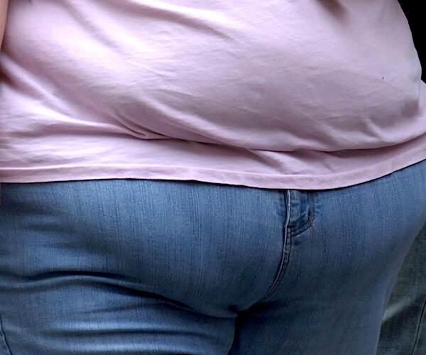 an obese woman's midsection is shown