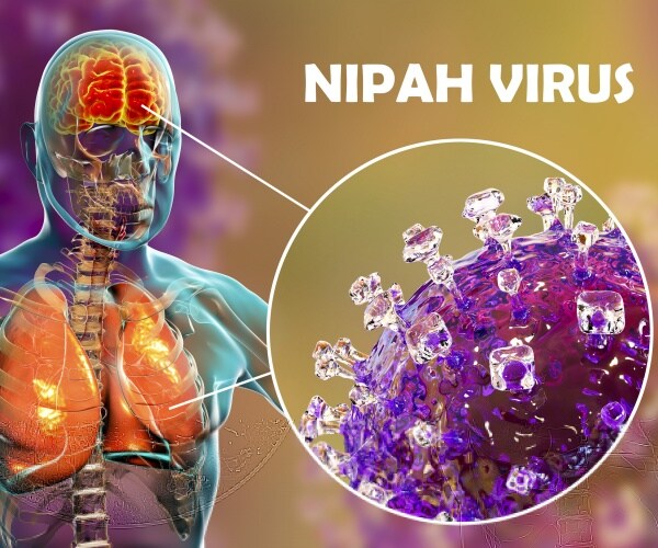 illustration of man labeled Nipah virus with head and chest highlighted 