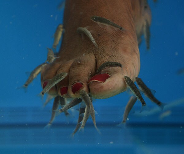 Fish Pedicure Caused Woman's Toenails to Fall Off?