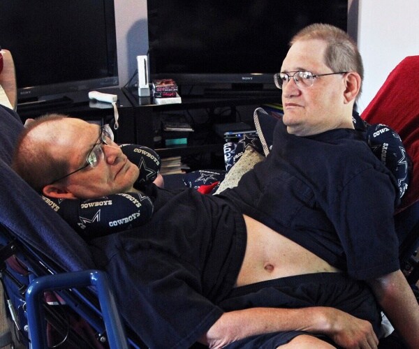 galyon conjoined twins sit down wearing black t shirts