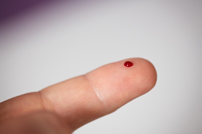 Finger-Stick Blood Test Detects Alzheimer's Markers