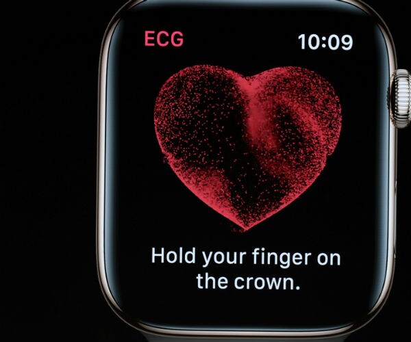 Apple Watch Detects Irregular Heart Beat in Large U.S. Study