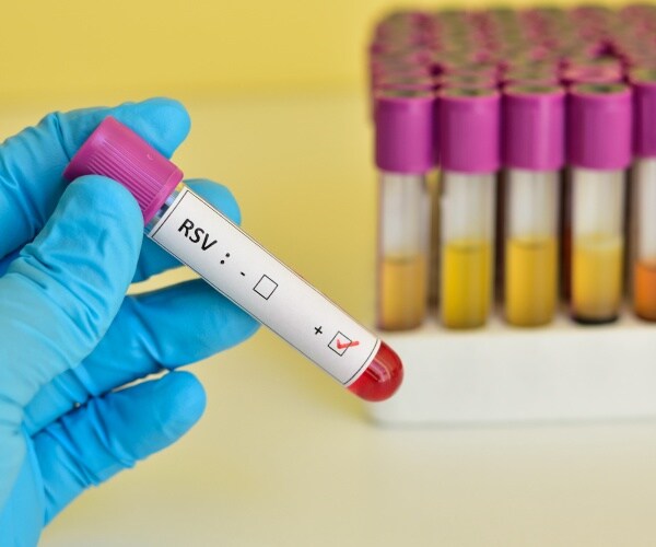 vial of blood labeled positive for RSV